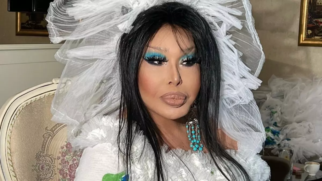 BÜLENT ERSOY’un TEKNESİ SATILIK MI? İLAN SOSYAL MEDYAYI SALLADI