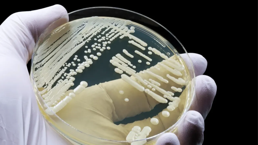 İLAÇLAR BİLE ÇÖZÜM OLMUYOR! ÖLÜMCÜL MANTAR HASTALIĞI KORKU SAÇIYOR