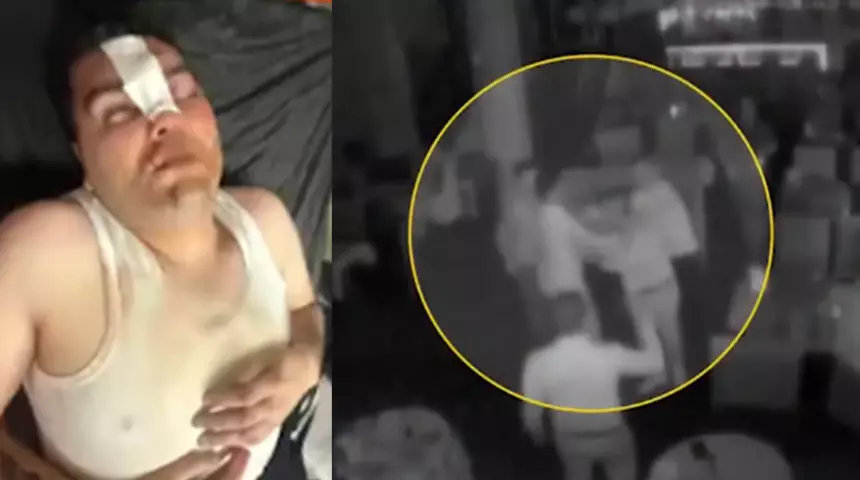 13 Bin 500 TL’lik Çerez Krizi, Ölümden Döndü