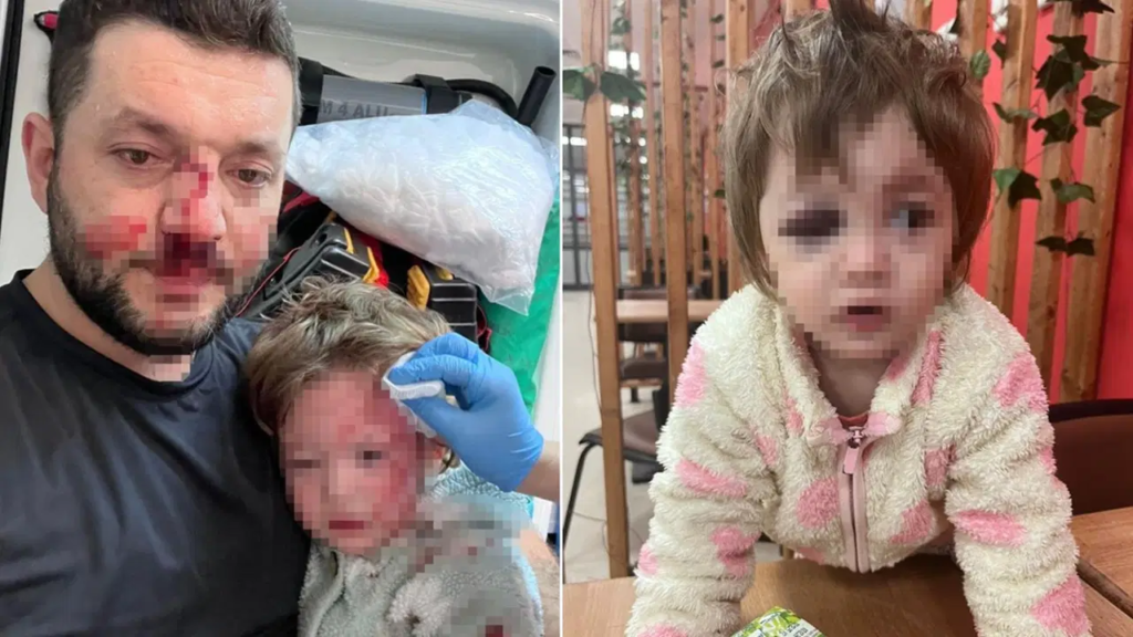 Yalova’da Dehşet! 14 Aylık Bebeğin Kafatası Çatladı