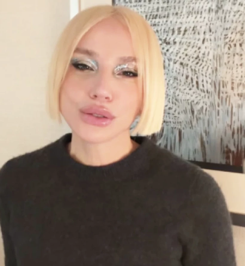 Gülşen’in Paylaşımı Olay yarattı! “Mimikleri Oynamıyor