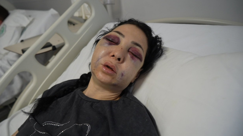 Anne ve Oğluna Darp Sonrası Tehdit İddiası