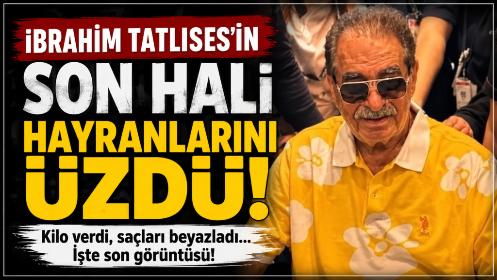 İbrahim Tatlıses’in Değişimi Dikkat Çekti