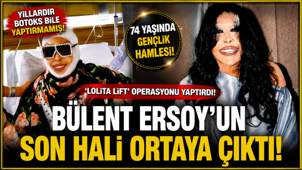 74 Yaşında ‘Lolita Lift’ Operasyonu