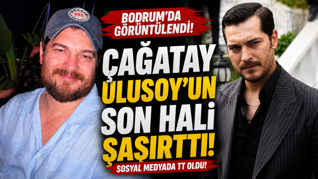 Çağatay Ulusoy’un eski halinden eser kalmamış